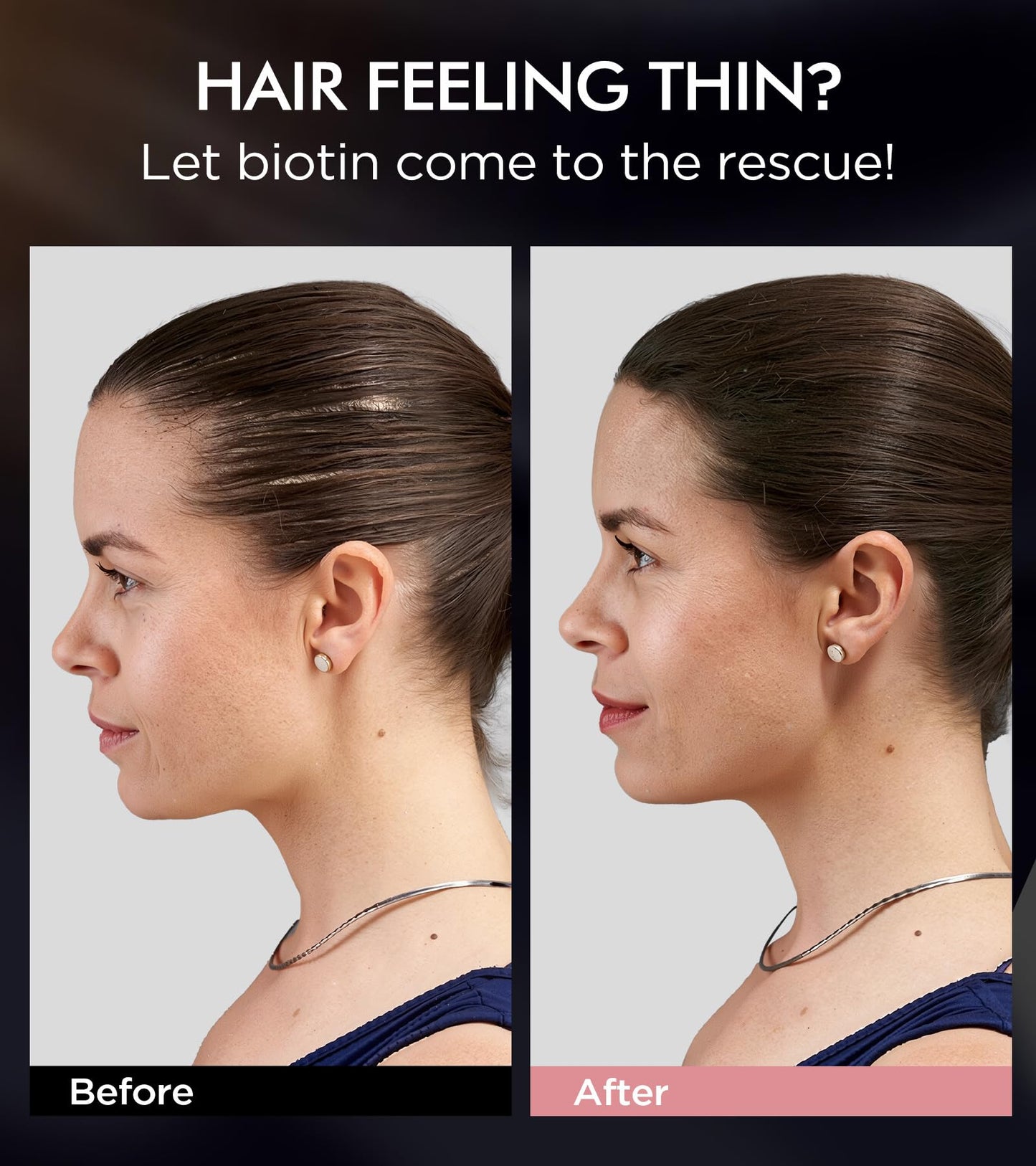 Tripeptide-Infused Hair Growth Biotin Shampoo and Conditioner Set, Onion Anti-Loss Volumizing Moisturizing Treatment for Soft Shine Hair, Rosemary Clarifying Dandruff Shampoo for Women Men, 2 x 16.9oz