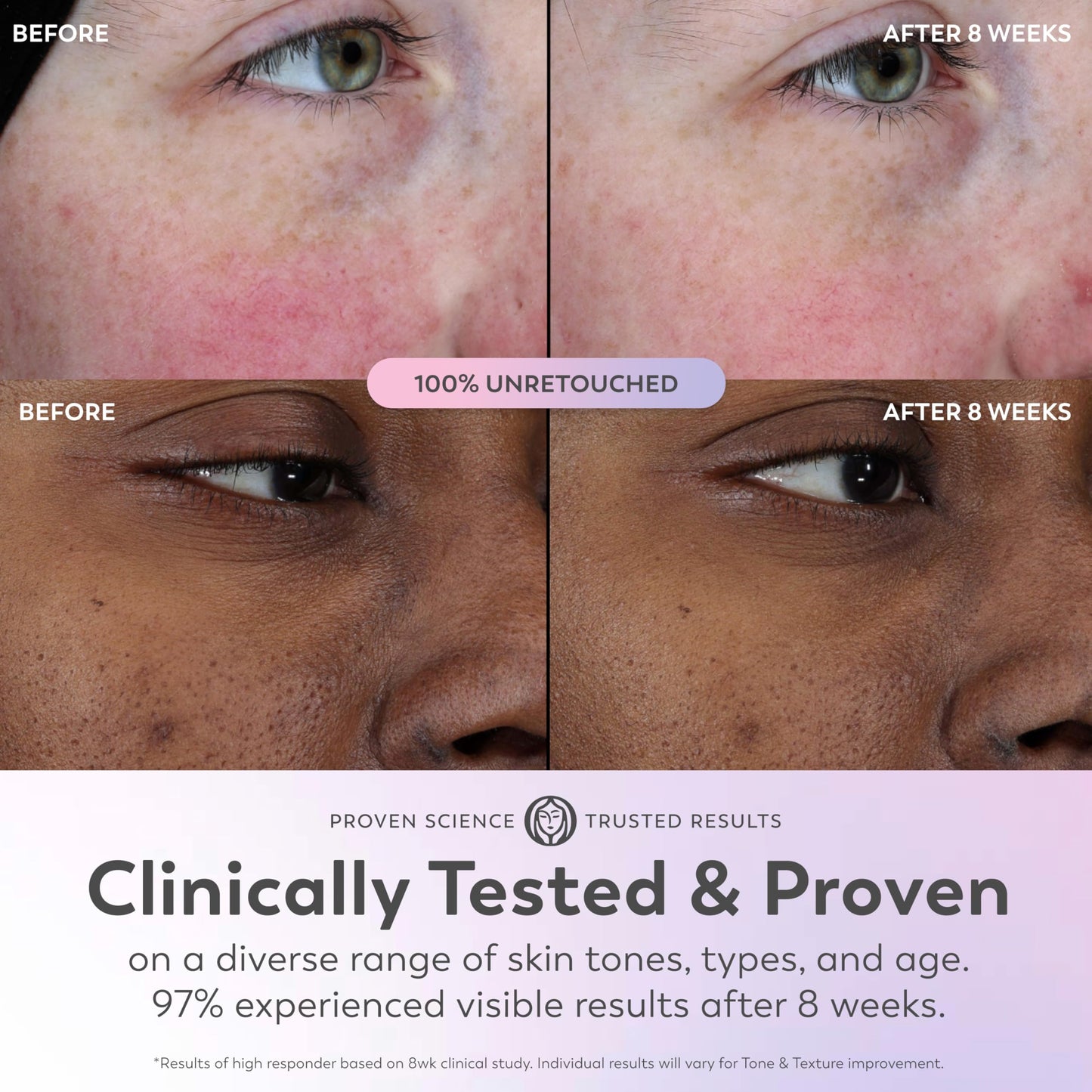 Olay Super Serum - Niacinamide, Vitamin C & E, Collagen Peptide, AHA - 5-in-1 Skin Care Benefits for Face - Healthy Glow, Brightening, Hydrating, Smoothing, Firming, Evens Tone, Anti-Aging, 1.0 Oz