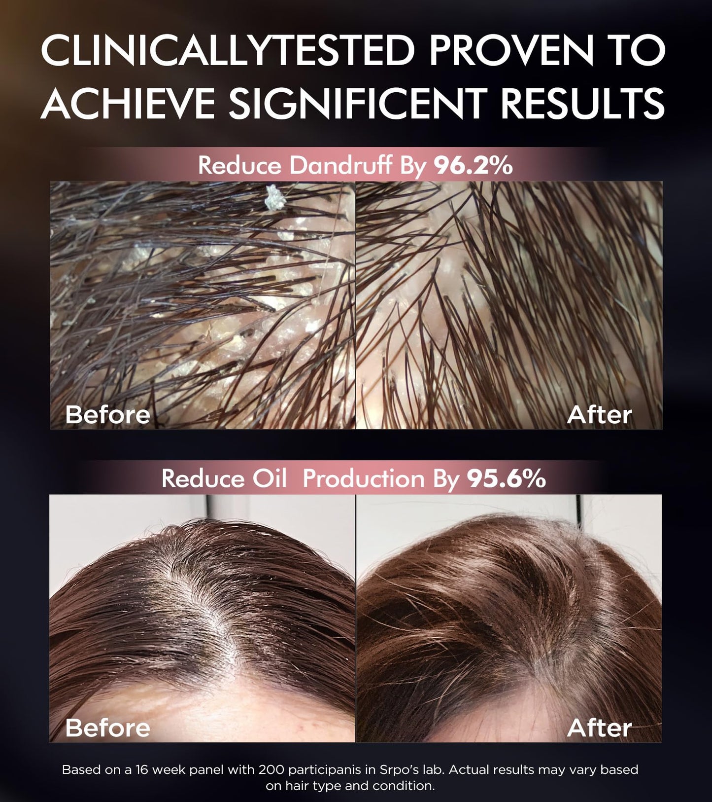 Tripeptide-Infused Hair Growth Biotin Shampoo and Conditioner Set, Onion Anti-Loss Volumizing Moisturizing Treatment for Soft Shine Hair, Rosemary Clarifying Dandruff Shampoo for Women Men, 2 x 16.9oz