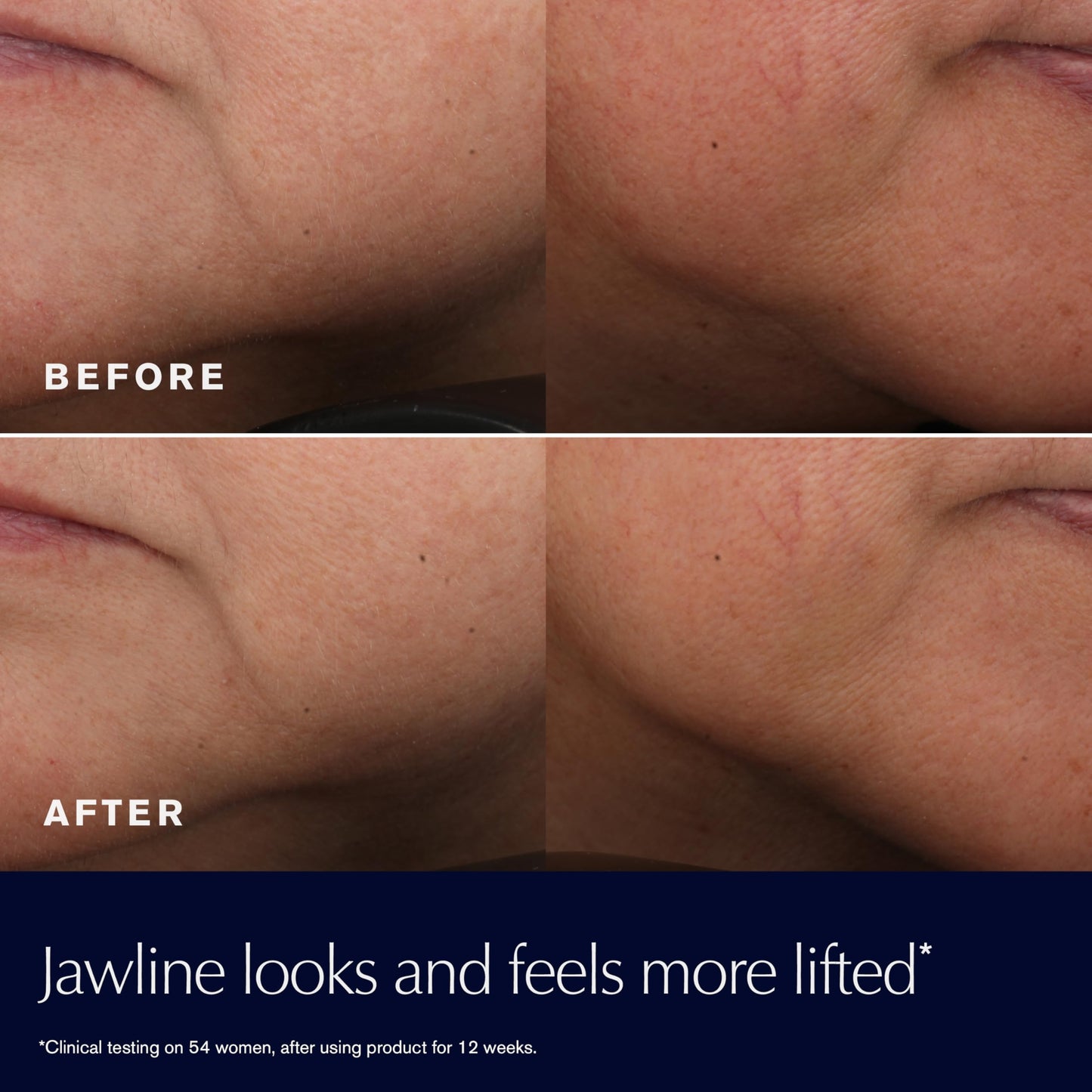 Estée Lauder Revitalizing Supreme+ Youth Power Cream | Face Moisturizer with Hyaluronic Acid & Peptides | Anti-Aging, 2.5 Ounce