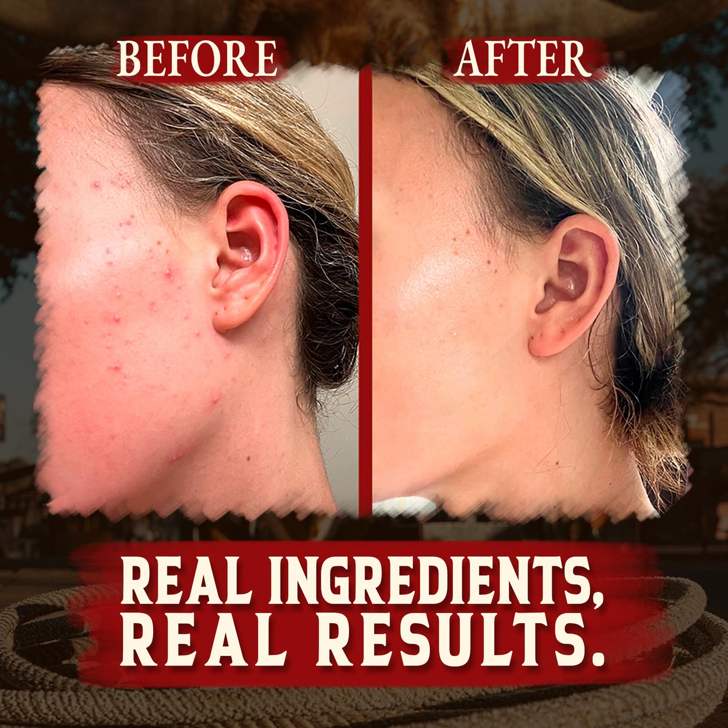 Wrath & Remedy Handmade Whipped Organic Beef Tallow for Skin - 4 OZ (Unscented) — Grass Fed Beef Tallow Moisturizer and Honey Balm for Silky, Sensitive-Skin, Eczema, Rosacea - Free of Harsh Chemicals